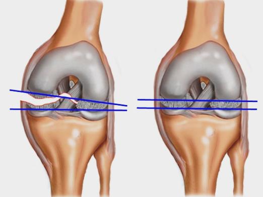 O que são ligamentos?